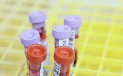 Vanliga läkarundersökningar vid IBS och andra magproblem