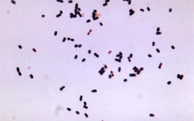 PI-IBS, magsjuka och turistdiarré