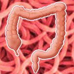 Orsakar bakterien Brachyspira IBS?